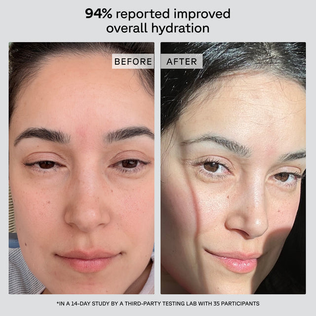 Before and after images of ACure The Super Drench Serum by Organax Ltd showing skin hydration and glow effects.